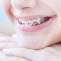orthodontics-braces-love-brushing-dentistry