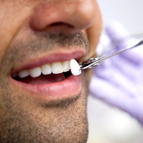 cosmetic dentistry-love-brushing-dentistry