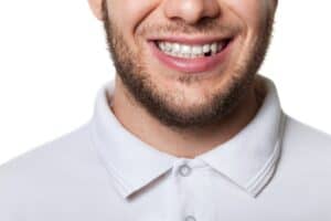 Replacing missing teeth is essential for the preservation of your smile. Call Houston family dentist Dr. Sanaz Khavari at 713-490-2088 to learn more
