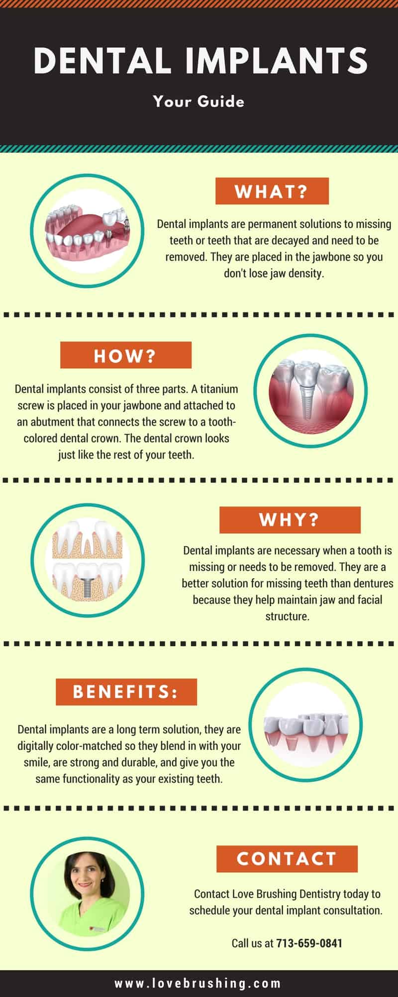 Dental Implants | Houston Dentistry