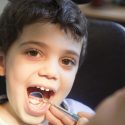 cavity repair for children - Pasadena, TX