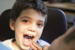 cavity repair for children - Pasadena, TX
