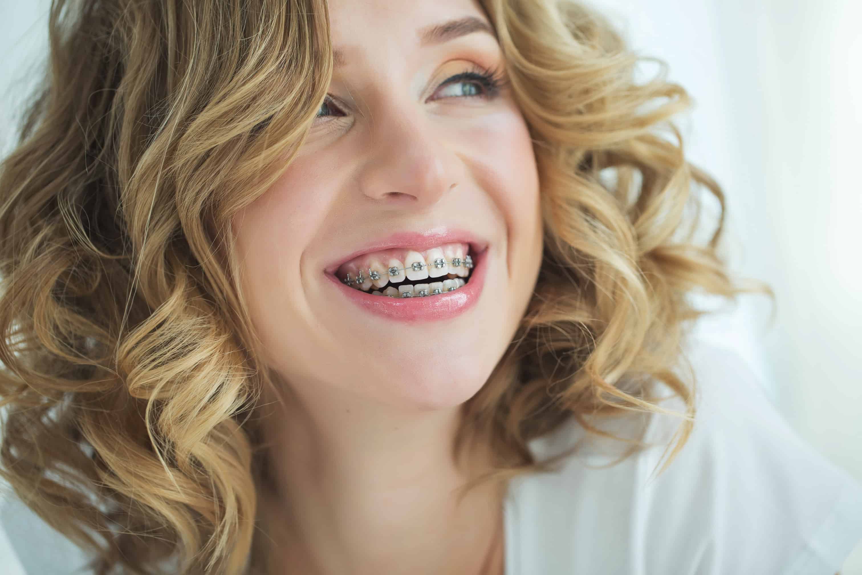 5 Reasons To Consider Getting Braces As An Adult Pasadena 