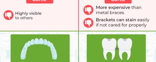 Best Orthodontic Options for Kids