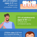infographic highlighting 5 facts about tooth decay in children